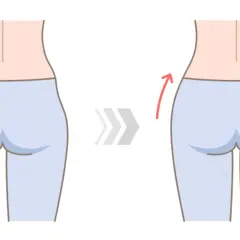 Ilustración de una mujer mostrando la reducción de los hip dips.