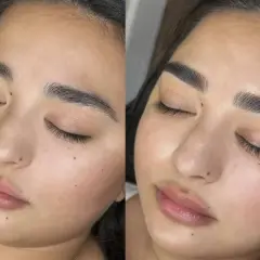Comparativa antes y después de micropigmentación cejas. Cejas más definidas y oscuras tras el tratamiento.