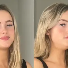 Comparación de un rostro con y sin la técnica de "mewing", mostrando cómo la posición de la lengua puede definir la mandíbula.