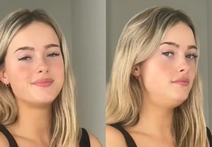 Comparación de un rostro con y sin la técnica de "mewing", mostrando cómo la posición de la lengua puede definir la mandíbula.