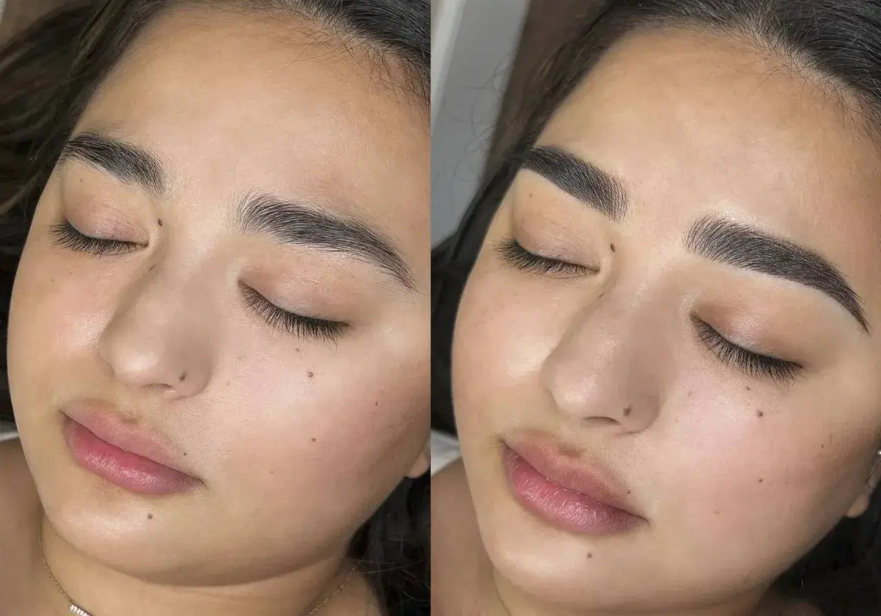 Comparativa antes y después de micropigmentación cejas. Cejas más definidas y oscuras tras el tratamiento.